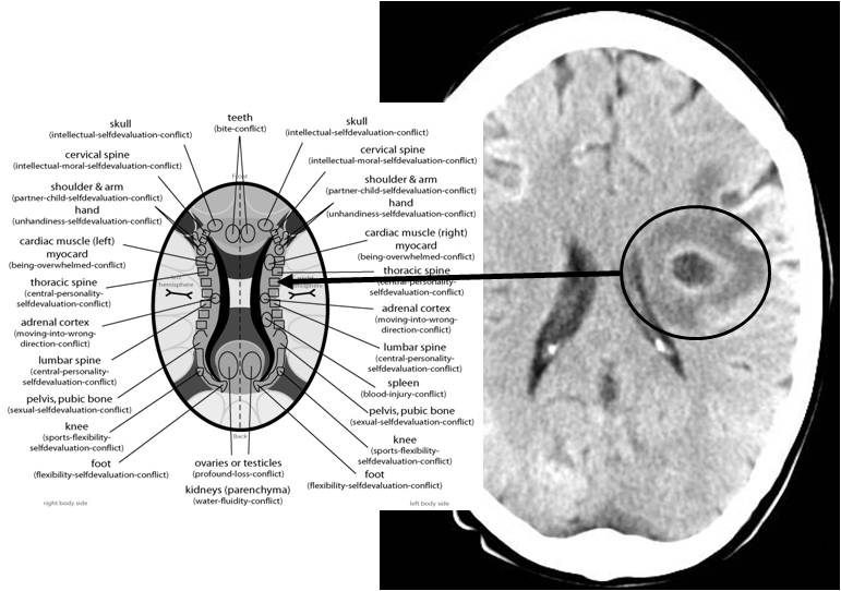 Book Samples Brain CT Examples Why am I Sick